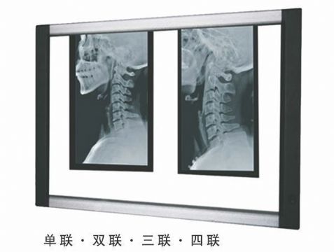 点击查看详细信息<br>标题：LED观片灯 阅读次数：1591